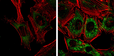 Anti-NDP52 antibody [GT1813] used in Immunocytochemistry/ Immunofluorescence (ICC/IF). GTX630397