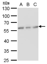 Anti-NDP52 antibody [GT1813] used in Western Blot (WB). GTX630397
