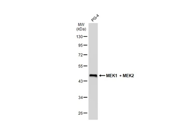 Anti-MEK1 + MEK2 antibody [GT1721] used in Western Blot (WB). GTX630542