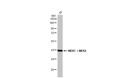 Anti-MEK1 + MEK2 antibody [GT1721] used in Western Blot (WB). GTX630542