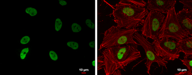 Anti-Histone H3K9ac (Acetyl Lys9) antibody [GT464] used in Immunocytochemistry/ Immunofluorescence (ICC/IF). GTX630554