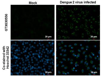 Anti-Dengue virus NS1 protein antibody [GT4212] used in Immunocytochemistry/ Immunofluorescence (ICC/IF). GTX630556
