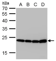 Anti-SOD2 antibody [GT582] used in Western Blot (WB). GTX630558