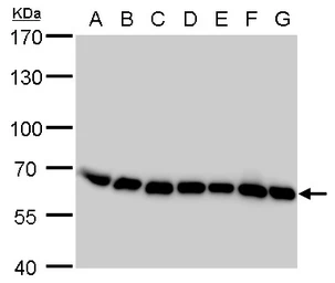 Anti-COPD antibody [GT189] used in Western Blot (WB). GTX630561