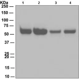 Anti-Caspase 8 antibody [EPR162] used in Western Blot (WB). GTX63075