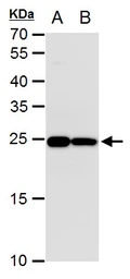Anti-Triosephosphate isomerase antibody [GT181] used in Western Blot (WB). GTX630779