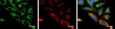 Anti-FIS1 antibody [GT4211] used in Immunocytochemistry/ Immunofluorescence (ICC/IF). GTX630983