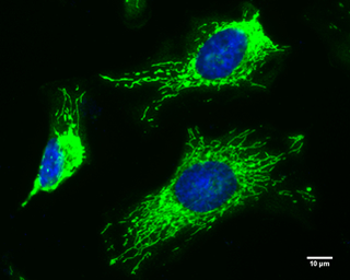 Anti-FIS1 antibody [GT4211] used in Immunocytochemistry/ Immunofluorescence (ICC/IF). GTX630983