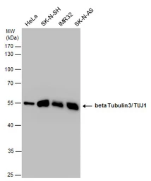 Anti-beta Tubulin 3/ Tuj1 antibody [GT886] used in Western Blot (WB). GTX631830