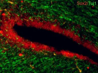 Anti-beta Tubulin 3/ Tuj1 antibody [GT886] used in IHC (Frozen sections) (IHC-Fr). GTX631830