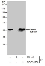 Anti-beta Tubulin 3/ Tuj1 antibody [GT886] used in Immunoprecipitation (IP). GTX631830