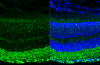 Anti-beta Tubulin 3/ Tuj1 antibody [GT886] used in IHC (Paraffin sections) (IHC-P). GTX631830