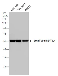 Anti-beta Tubulin 3/ Tuj1 antibody [GT1338] used in Western Blot (WB). GTX631831
