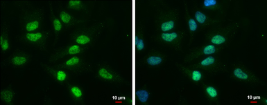 Anti-TDG antibody [GT1142] used in Immunocytochemistry/ Immunofluorescence (ICC/IF). GTX631934