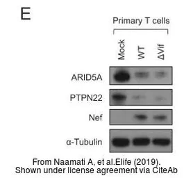Anti-ARID5A antibody [GT18112] used in Western Blot (WB). GTX631940