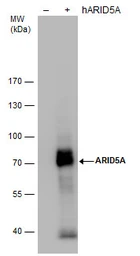 Anti-ARID5A antibody [GT18112] used in Western Blot (WB). GTX631940