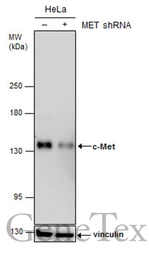 Anti-c-Met antibody [GT1586] used in Western Blot (WB). GTX631993