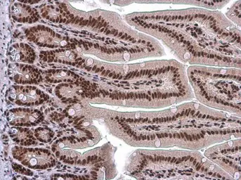 Anti-ARID1A antibody [GT3611] used in IHC (Paraffin sections) (IHC-P). GTX632013