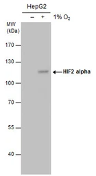 Anti-HIF2 alpha antibody [GT125] used in Western Blot (WB). GTX632015