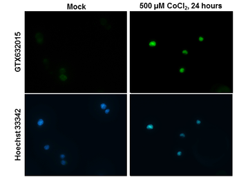 Anti-HIF2 alpha antibody [GT125] used in Immunocytochemistry/ Immunofluorescence (ICC/IF). GTX632015