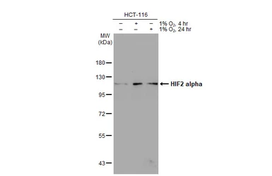 Anti-HIF2 alpha antibody [GT125] used in Western Blot (WB). GTX632015