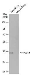 Anti-GOT1 antibody [GT1342] used in Western Blot (WB). GTX632032