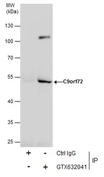 Anti-C9orf72 antibody [GT779] used in Immunoprecipitation (IP). GTX632041