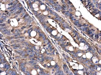 Anti-C9orf72 antibody [GT779] used in IHC (Paraffin sections) (IHC-P). GTX632041