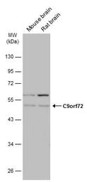 Anti-C9orf72 antibody [GT779] used in Western Blot (WB). GTX632041