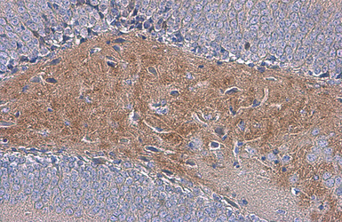 Anti-C9orf72 antibody [GT779] used in IHC (Paraffin sections) (IHC-P). GTX632041