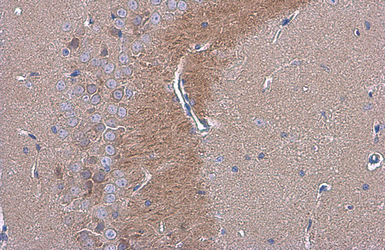 Anti-C9orf72 antibody [GT779] used in IHC (Paraffin sections) (IHC-P). GTX632041