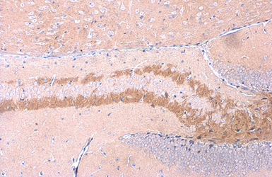 Anti-C9orf72 antibody [GT779] used in IHC (Paraffin sections) (IHC-P). GTX632041