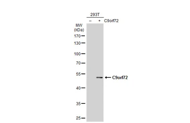 Anti-C9orf72 antibody [GT779] used in Western Blot (WB). GTX632041