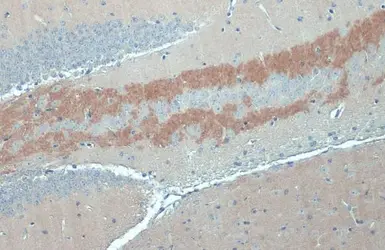 Anti-C9orf72 antibody [GT779] used in IHC (Paraffin sections) (IHC-P). GTX632041