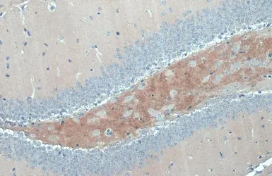 Anti-C9orf72 antibody [GT779] used in IHC (Paraffin sections) (IHC-P). GTX632041