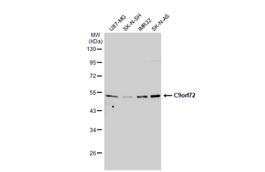 Anti-C9orf72 antibody [GT779] used in Western Blot (WB). GTX632041