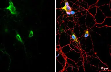 Anti-C9orf72 antibody [GT779] used in Immunocytochemistry/ Immunofluorescence (ICC/IF). GTX632041