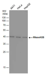 Anti-RNaseH2B antibody [GT419] used in Western Blot (WB). GTX632043