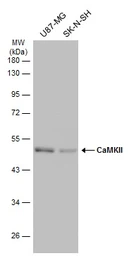 Anti-CaMKII antibody [GT4811] used in Western Blot (WB). GTX632127