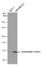 Anti-Glutaminase C (GAC) antibody [GT1075] used in Western Blot (WB). GTX632265