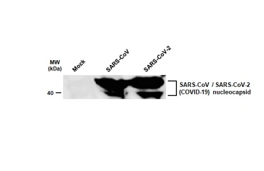 Anti-SARS-CoV / SARS-CoV-2 (COVID-19) Nucleocapsid antibody [6H3] used in Western Blot (WB). GTX632269