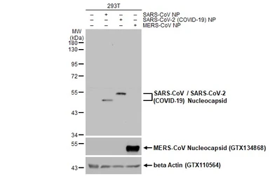 Anti-SARS-CoV / SARS-CoV-2 (COVID-19) Nucleocapsid antibody [6H3] used in Western Blot (WB). GTX632269