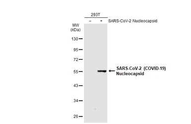 Anti-SARS-CoV / SARS-CoV-2 (COVID-19) Nucleocapsid antibody [6H3] used in Western Blot (WB). GTX632269