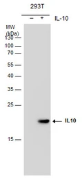Anti-IL10 antibody [GT5111] used in Western Blot (WB). GTX632359
