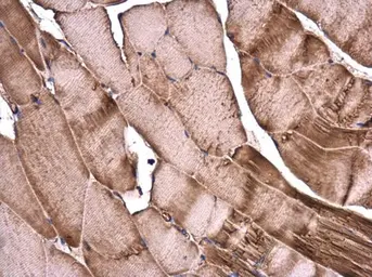 Anti-alpha Actinin 2 antibody [GT1253] used in IHC (Paraffin sections) (IHC-P). GTX632361