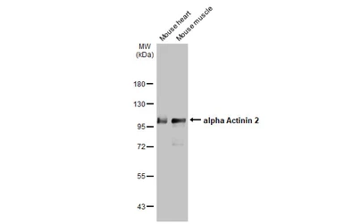 Anti-alpha Actinin 2 antibody [GT1253] used in Western Blot (WB). GTX632361