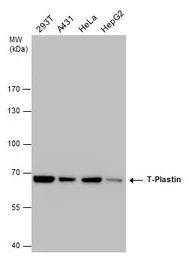 Anti-T-Plastin antibody [GT236] used in Western Blot (WB). GTX632481