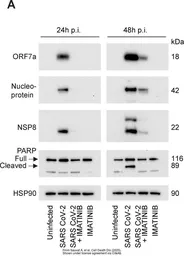 Anti-SARS-CoV / SARS-CoV-2 (COVID-19) ORF7a antibody [3C9] used in Western Blot (WB). GTX632602