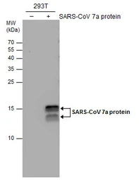 Anti-SARS-CoV / SARS-CoV-2 (COVID-19) ORF7a antibody [3C9] used in Western Blot (WB). GTX632602