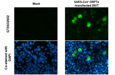 Anti-SARS-CoV / SARS-CoV-2 (COVID-19) ORF7a antibody [3C9] used in Immunocytochemistry/ Immunofluorescence (ICC/IF). GTX632602
